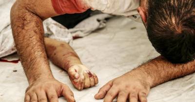 Segundo o Ministério da Saúde de Gaza, 108 pessoas ficaram feridas no último dia, aumentando para 75.298 o total de feridos.