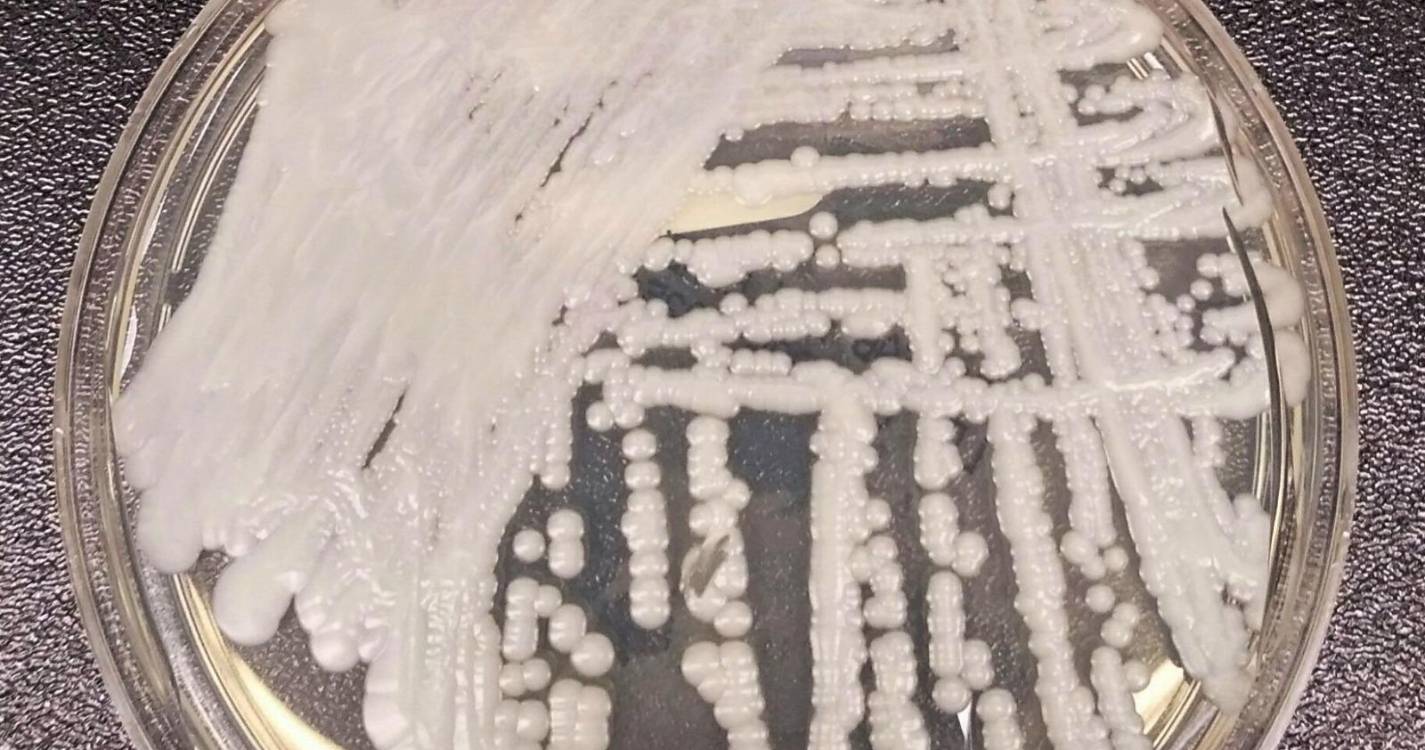 Infeções por Candida auris confirmadas em hospitais públicos entre 2022 e 2025