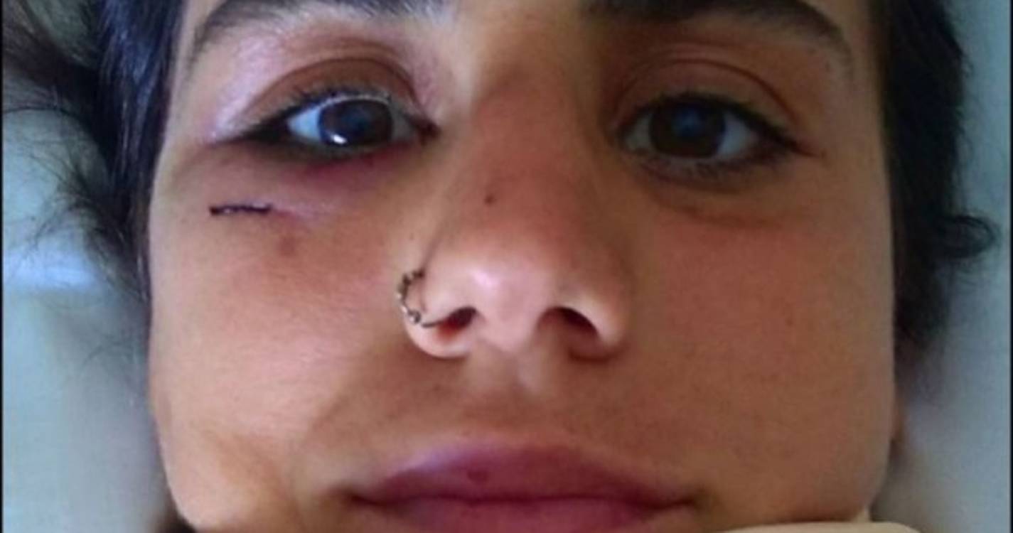 Apelo desesperado de jovem atropelada na autoestrada emociona famosos