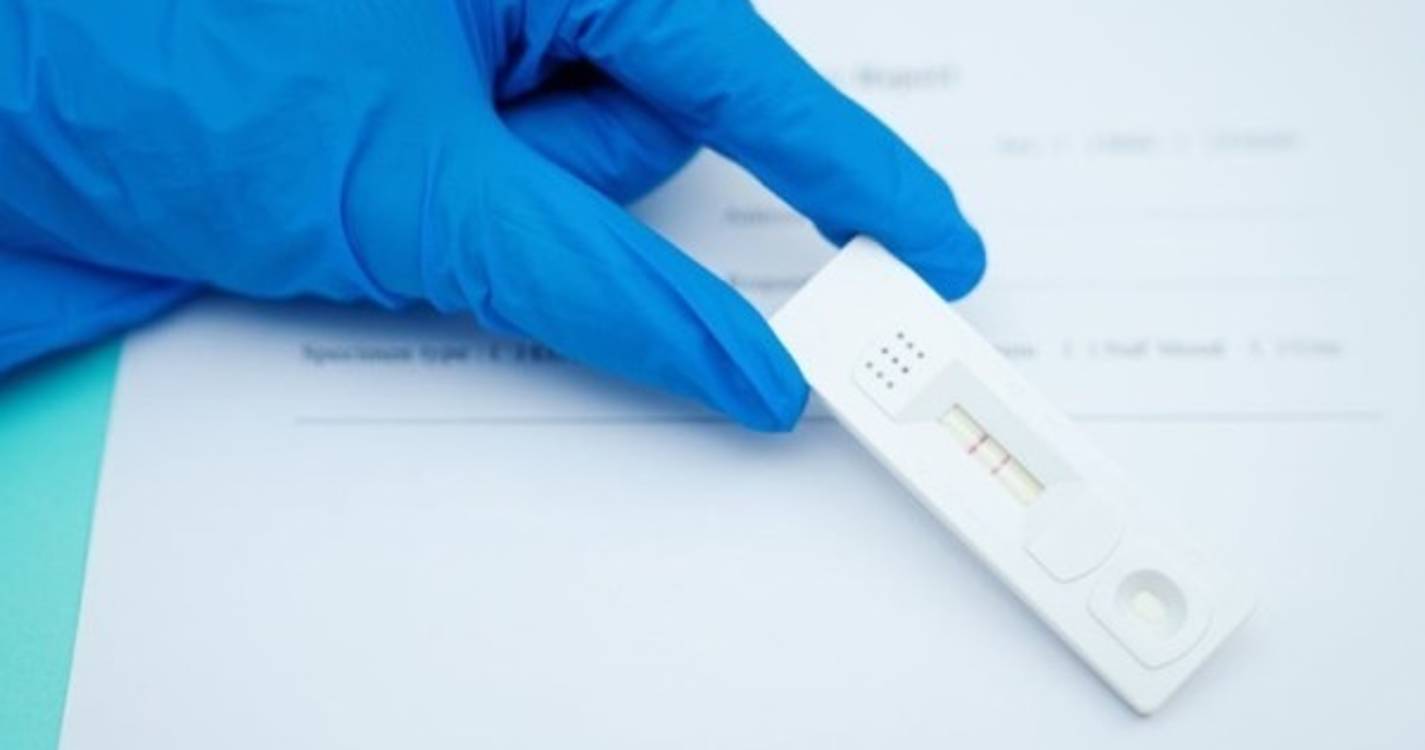 Farmácias venderam mais de um milhão de testes rápidos