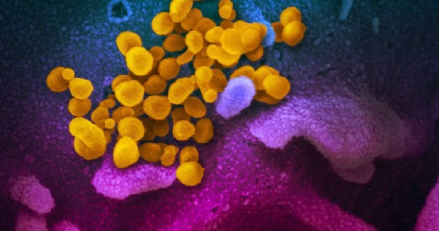 Cientistas suíços descobrem como evitar que coronavírus infete outras células