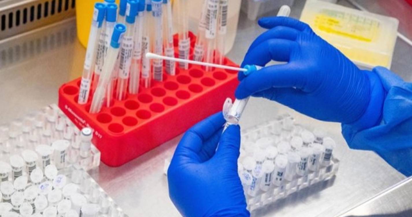 Centro europeu recomenda rastreio para Monkeypox quando já existem 67 casos na UE