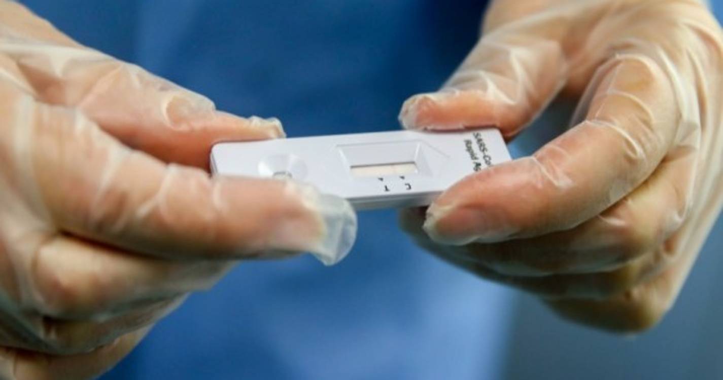 Testes rápidos de antigénio de uso profissional continuam gratuitos em fevereiro