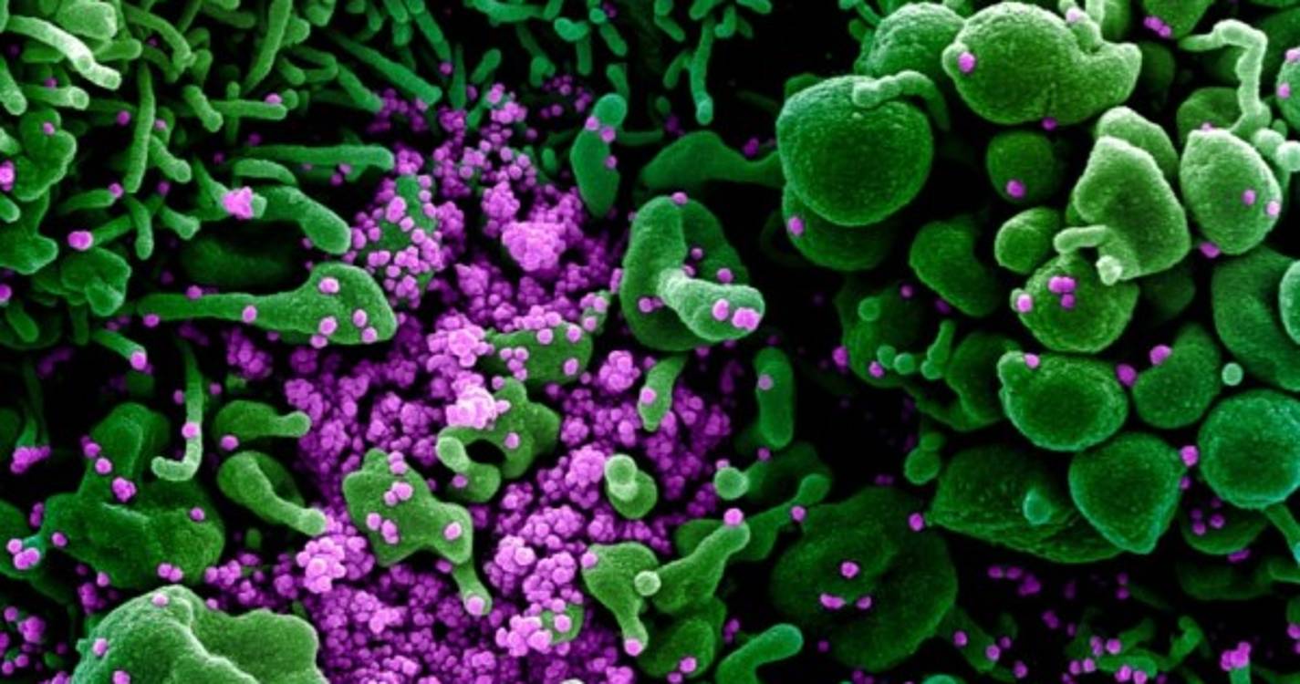 Covid-19: Novas linhagens mais transmissíveis mas ainda sem dados sobre gravidade