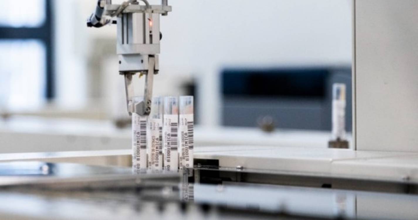 SESARAM garante que laboratório tem aumentado a capacidade de realização de análises não urgentes