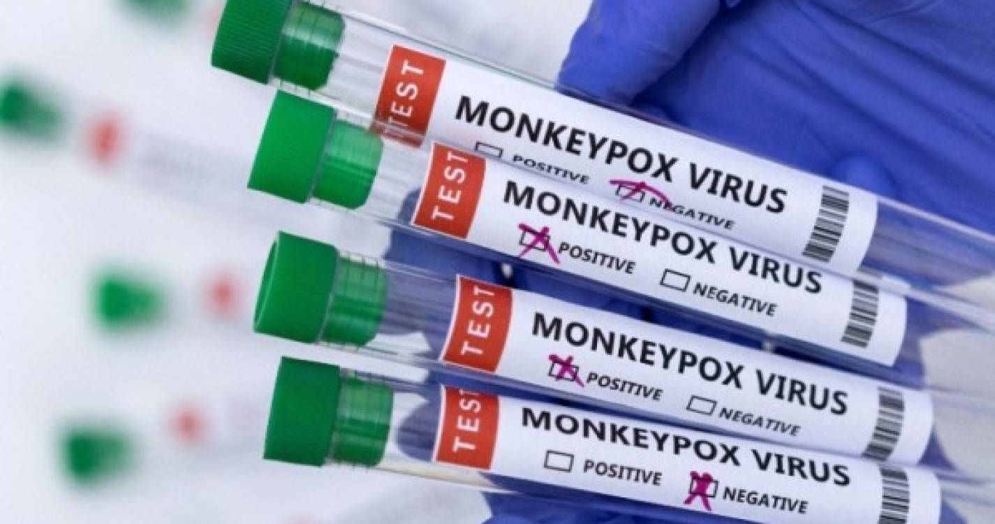 Portugal com 710 casos confirmados de infeção pelo vírus Monkeypox em três meses