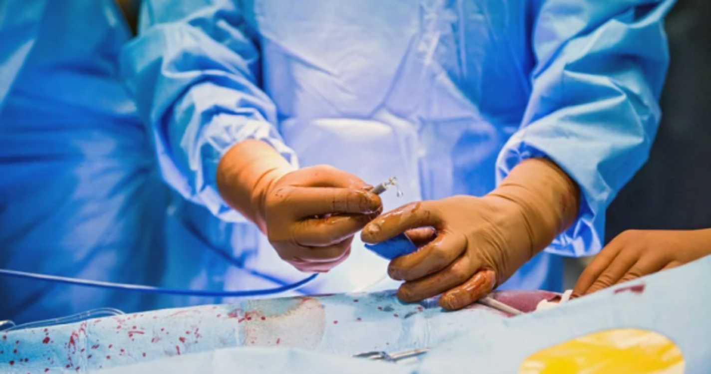 Cirurgia rara no D. Estefânia separou com êxito siamesas de quatro anos