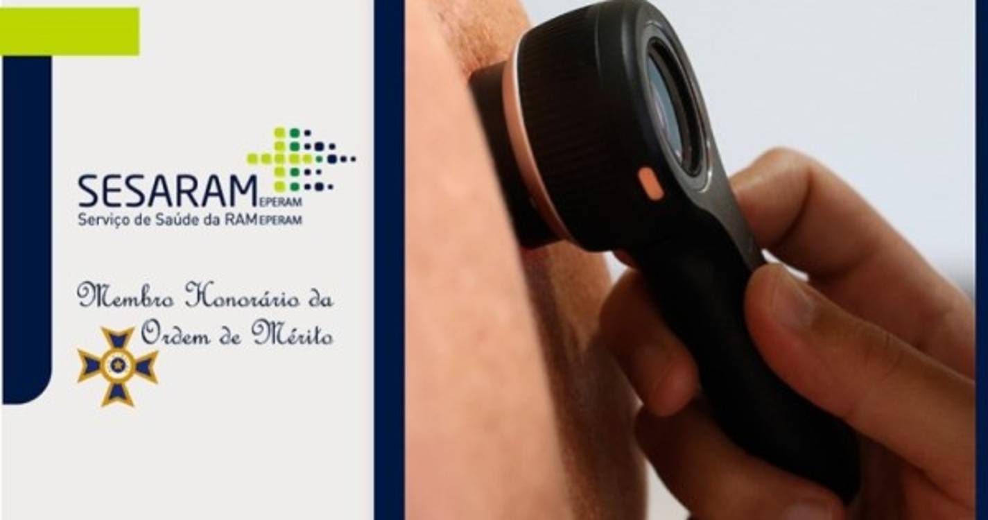 Serviço de Dermatologia do SESARAM realiza 130 rastreios cancro da pele