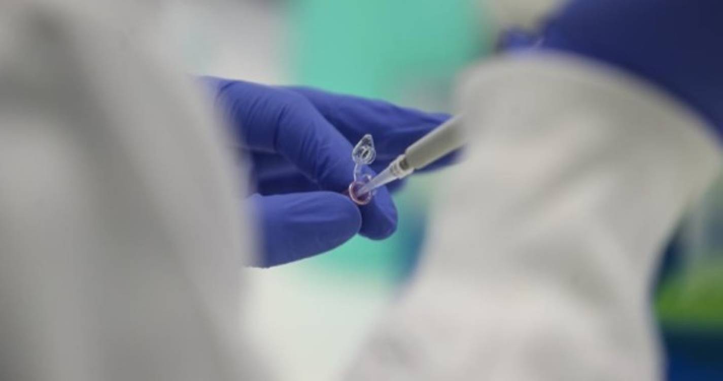 Portugal ultrapassa 500 casos confirmados de infeção por Monkeypox