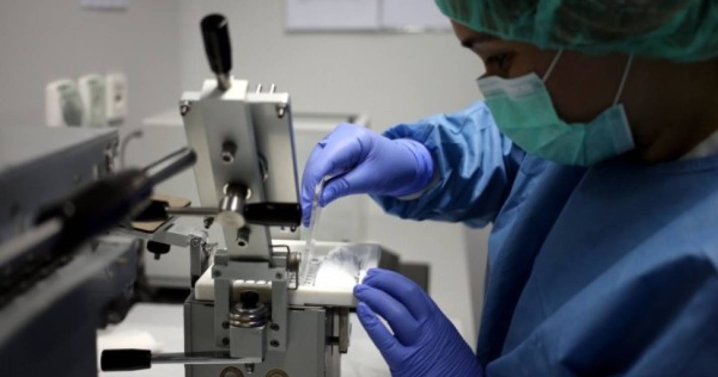 Israel e Suíça com casos de varíola e Espanha aprova regras para evitar contágios