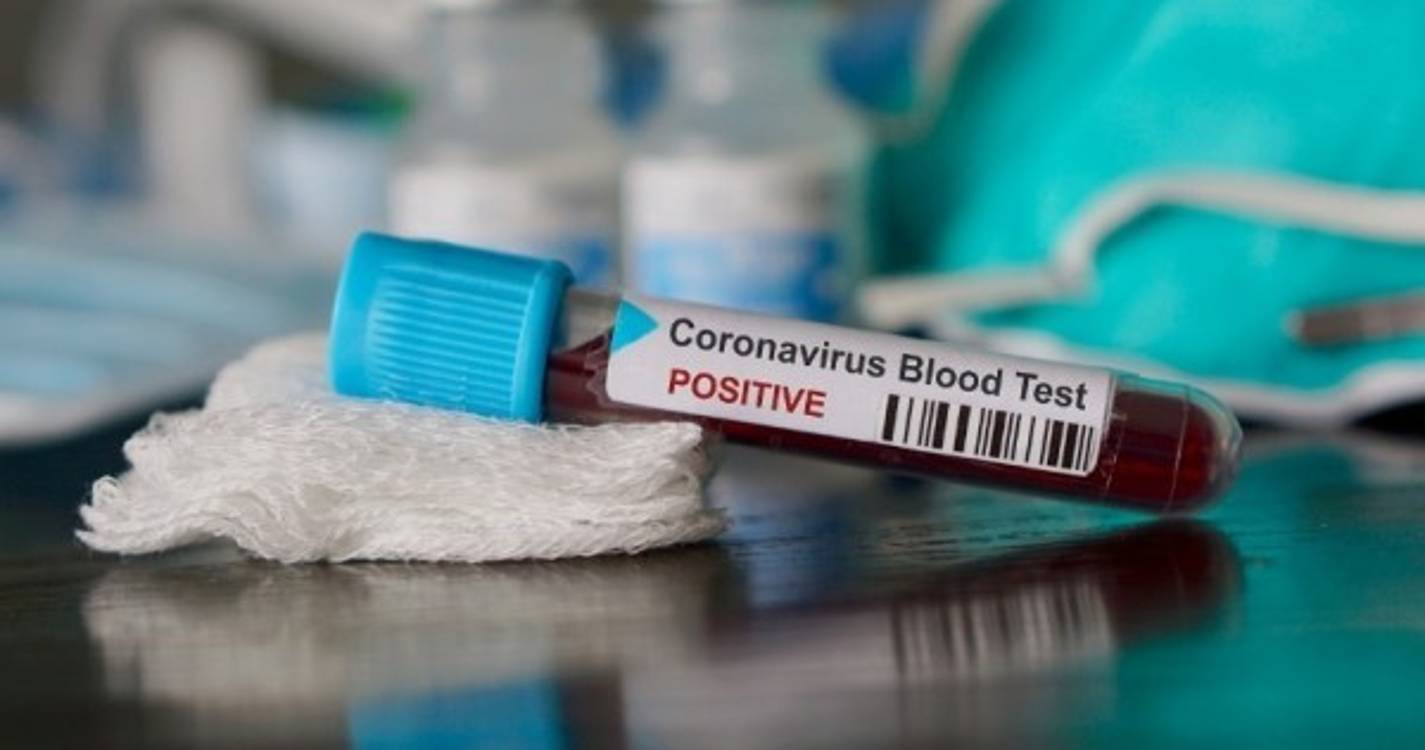 Covid-19: Quase metade de infetados com imunidade passados dez meses