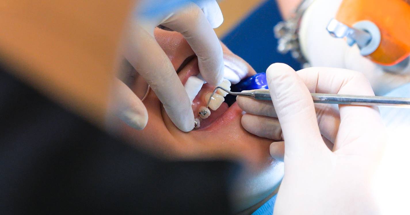 Mais de mil crianças colocaram aparelhos ortodônticos através do ‘+Sorriso’