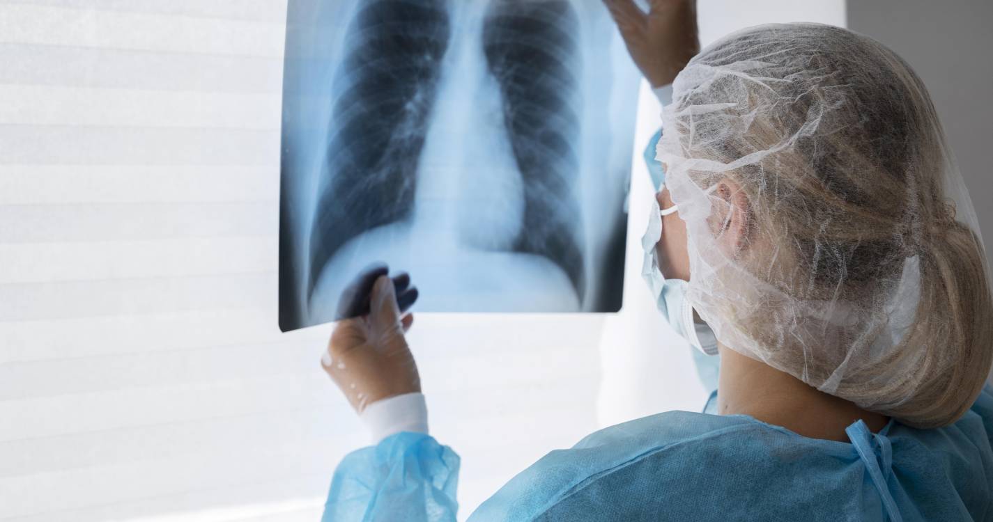 Detetado caso de tuberculose pulmonar num hotel na região de Lisboa - DGS