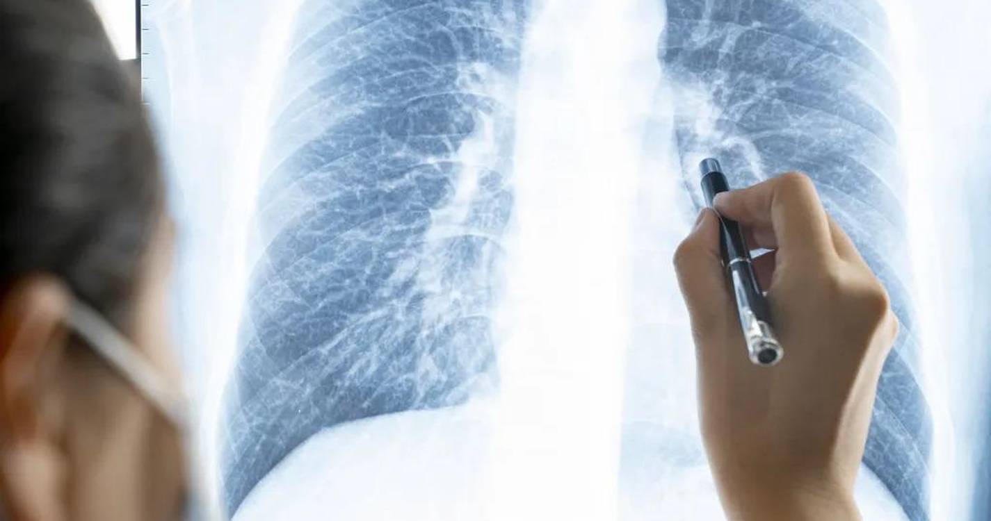 Doenças do aparelho circulatório e tumores representaram quase metade das mortes em 2022