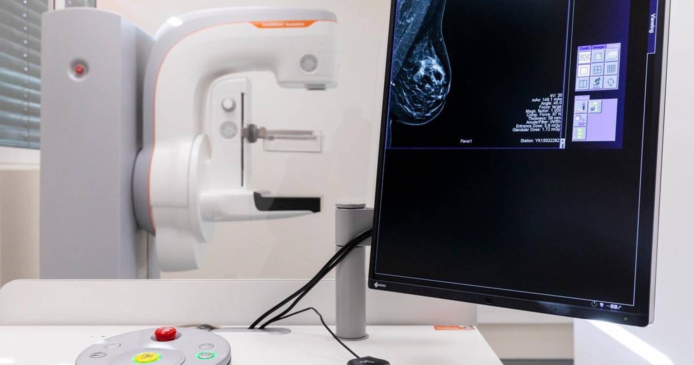 Liga preocupada com restrições a cirurgias ao cancro da mama