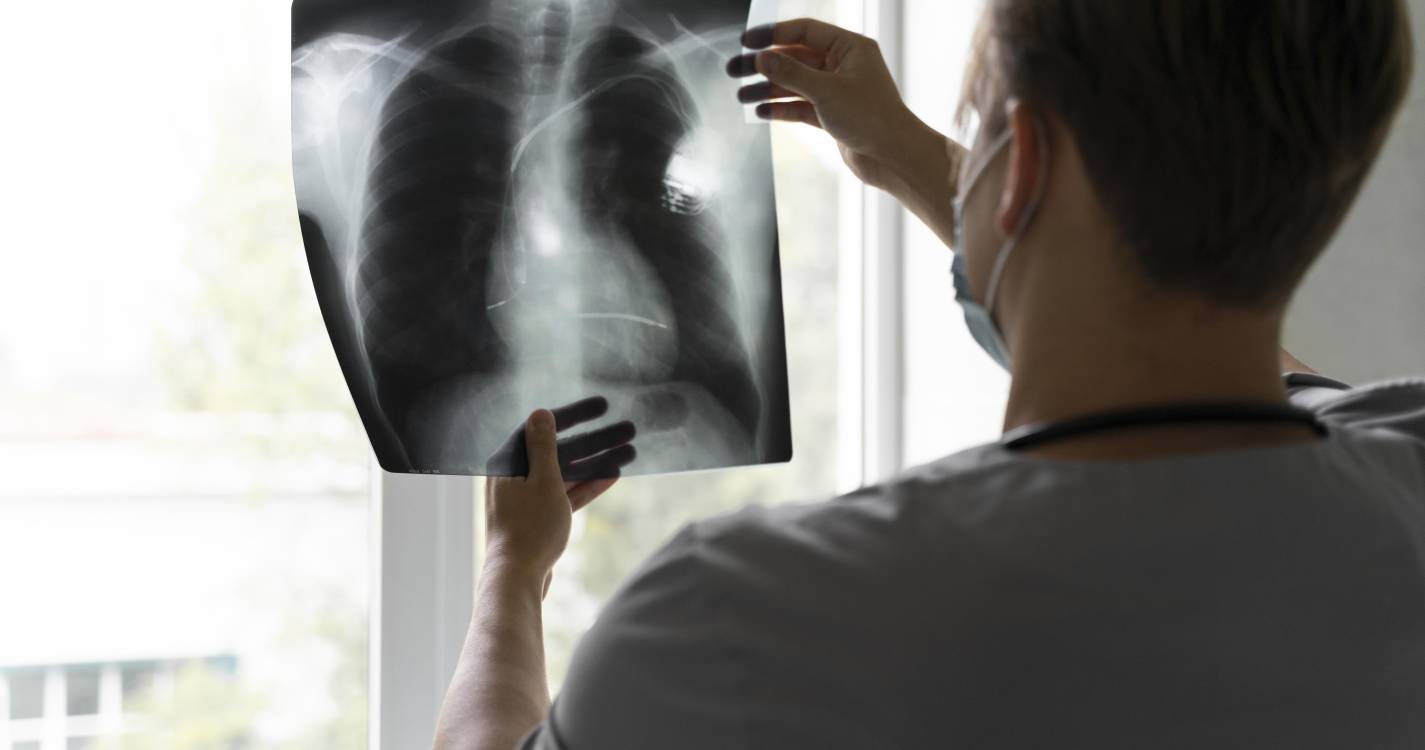 Pulmonale alerta para urgência de implementar rastreio do cancro do pulmão em Portugal