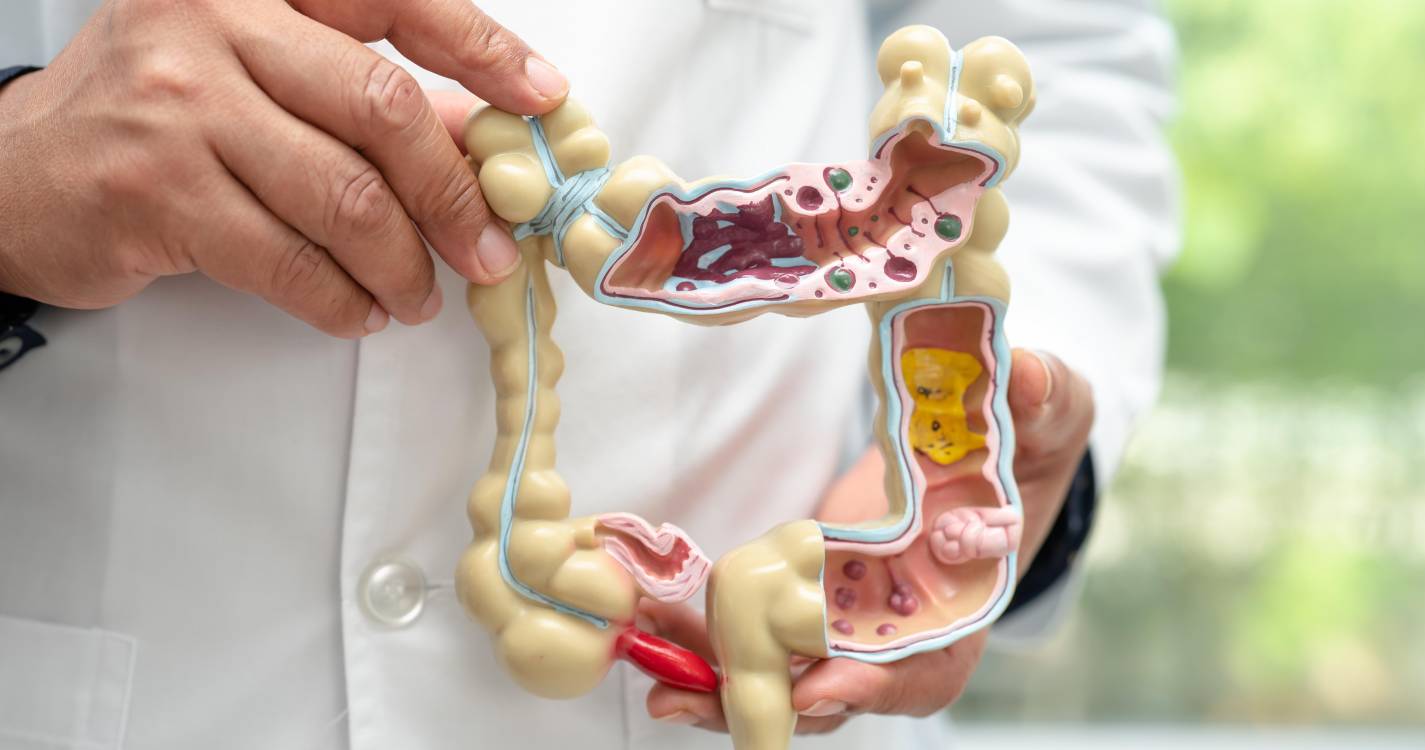 Investigadores portugueses mais perto de nova imunoterapia contra cancro colorretal