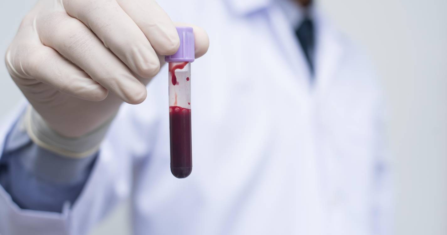 Análise ao sangue poderá substituir amostras de medula óssea na deteção da leucemia