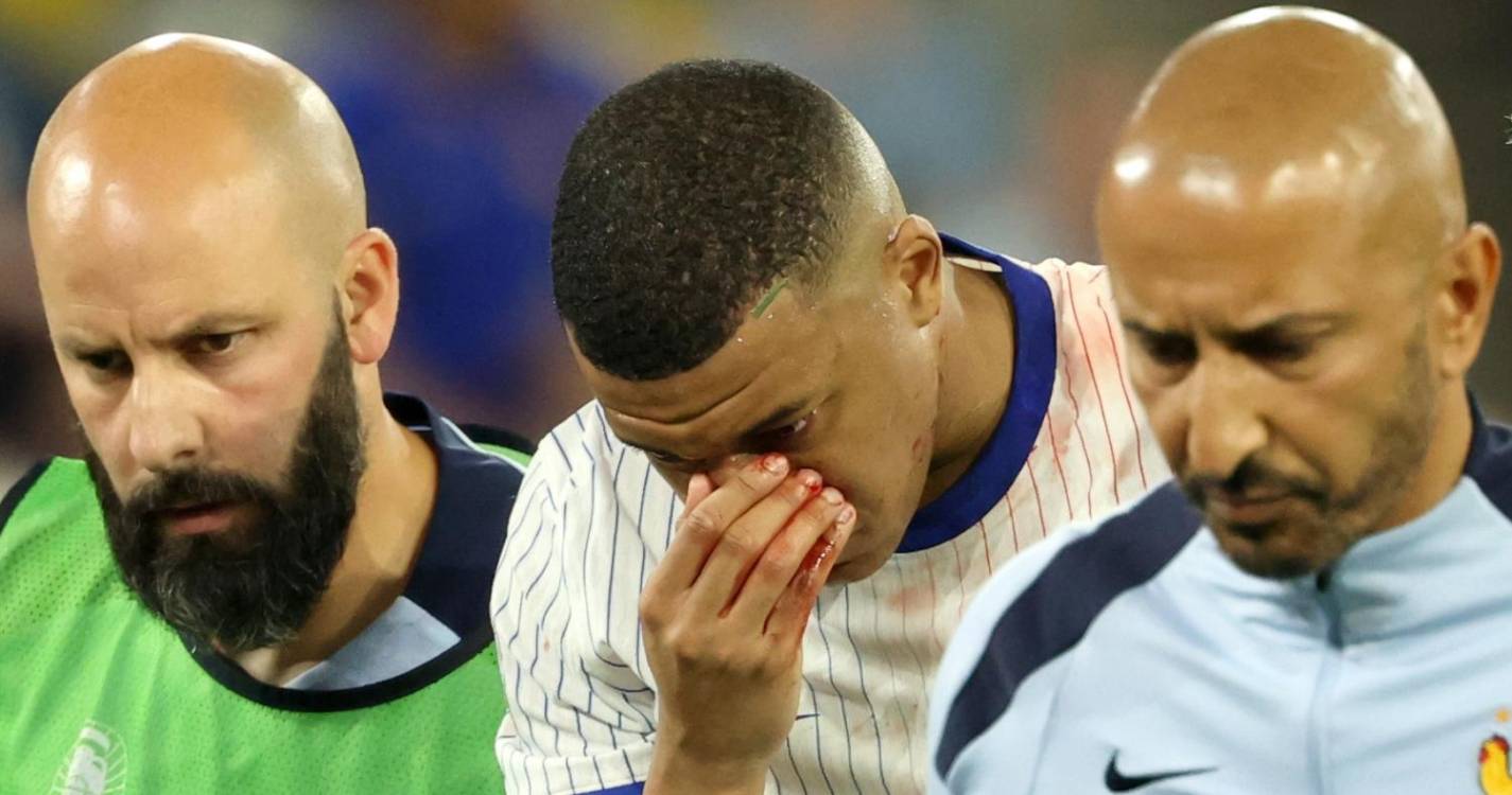 Euro2024: Mbappé terá de usar máscara para proteger fratura do nariz
