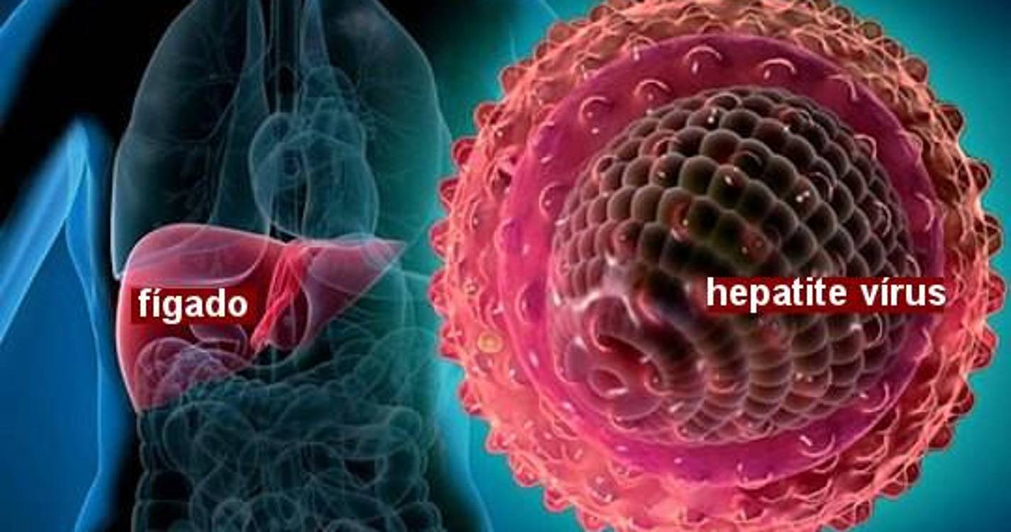Hepatite viral crónica afeta cinco milhões de pessoas na Europa