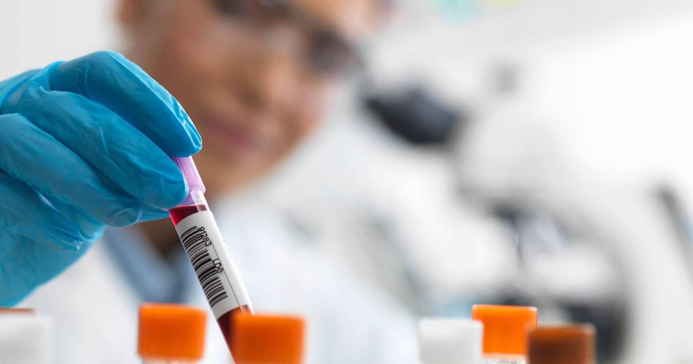 Menos casos de VIH em Portugal em 2024, mas maioria dos diagnósticos foi tardia