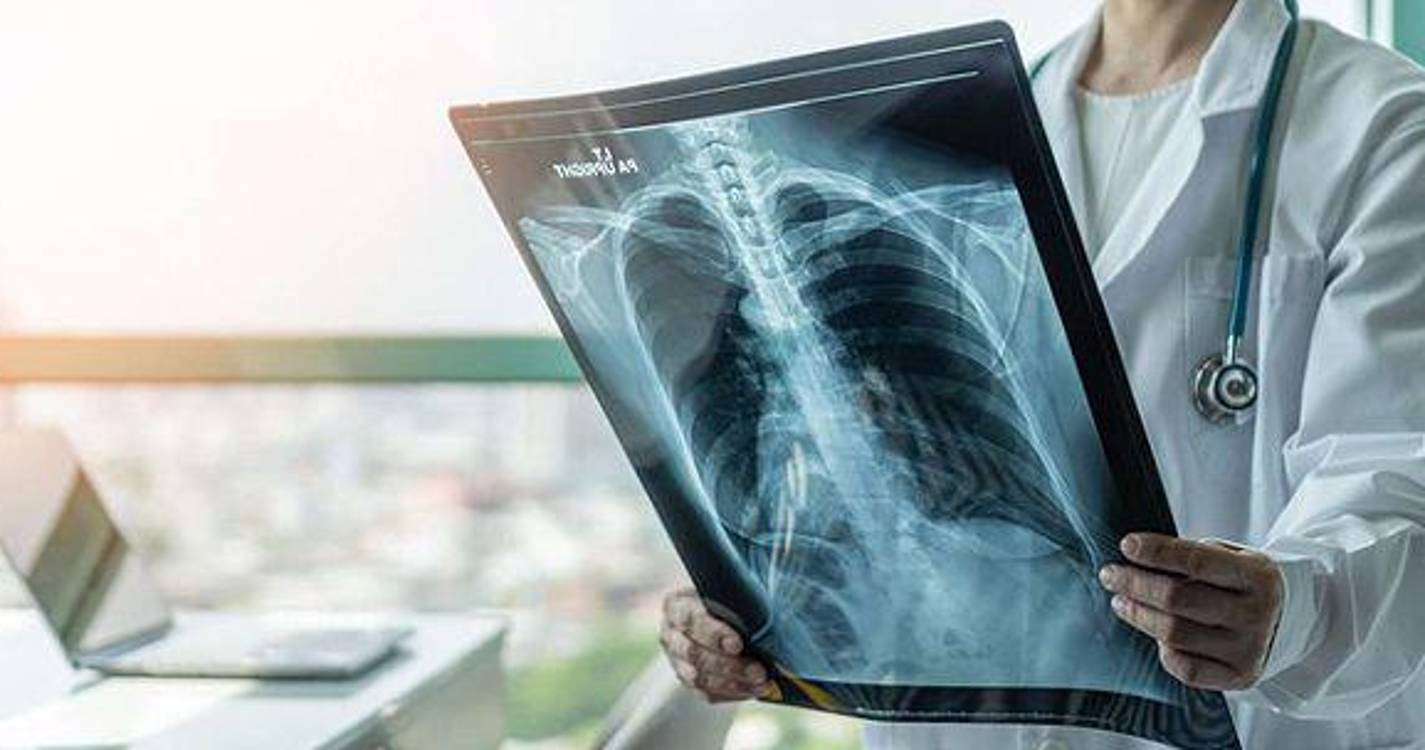 Sindicato dos técnicos de diagnóstico e terapêutica admite “avançar para a luta”