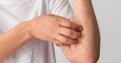 Autoridade de Saúde: “Doente com sarampo está estável e fora do risco de contágio”