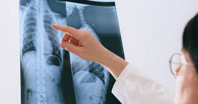 IASAÚDE investe mais de 2,2 milhões de euros em exames de radiologia