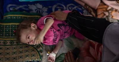 Falta de comida está a matar a população também à fome. Crianças são as principais vítimas.