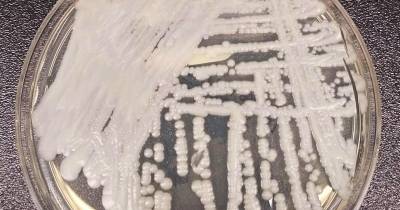 Infeções por Candida auris confirmadas em hospitais públicos entre 2022 e 2025