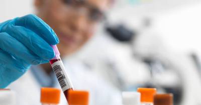 Portugal registou menos casos de infeção por VIH em 2024, totalizando 997, mas mais de metade dos diagnósticos ocorreram tardiamente.