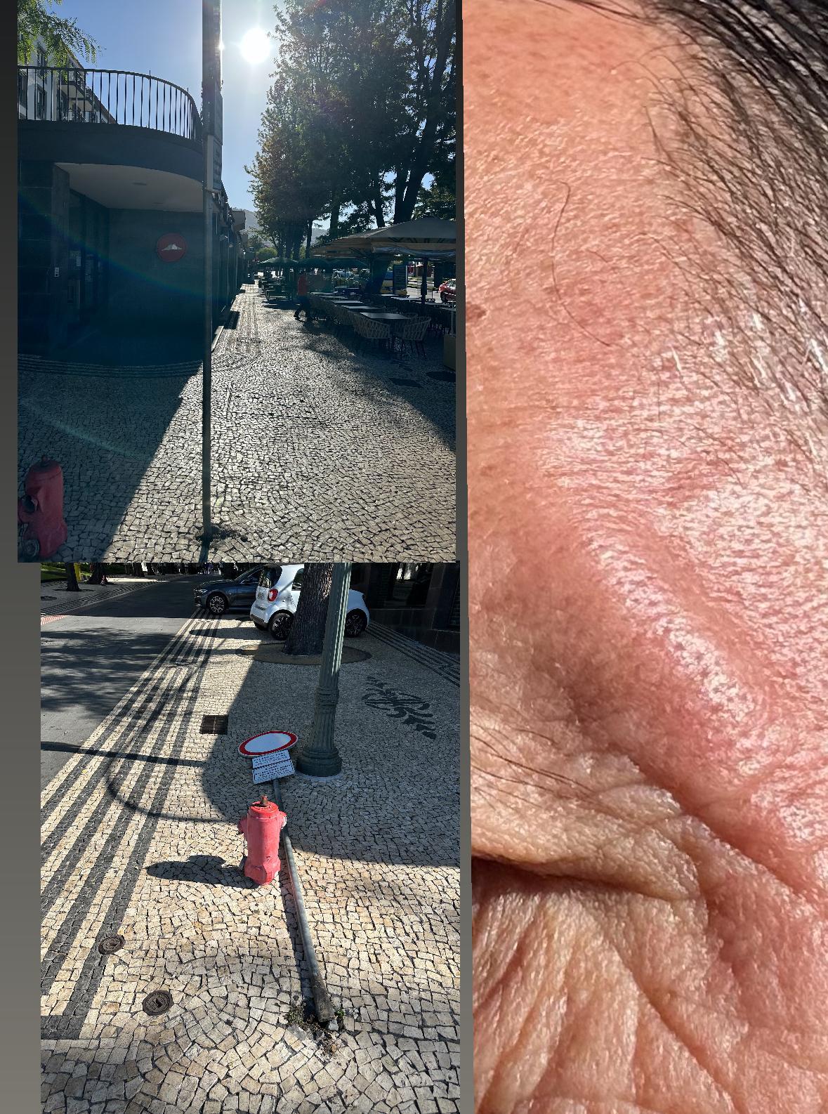 Homem derruba sinal de trânsito colocado em local de passagem de peões no Funchal